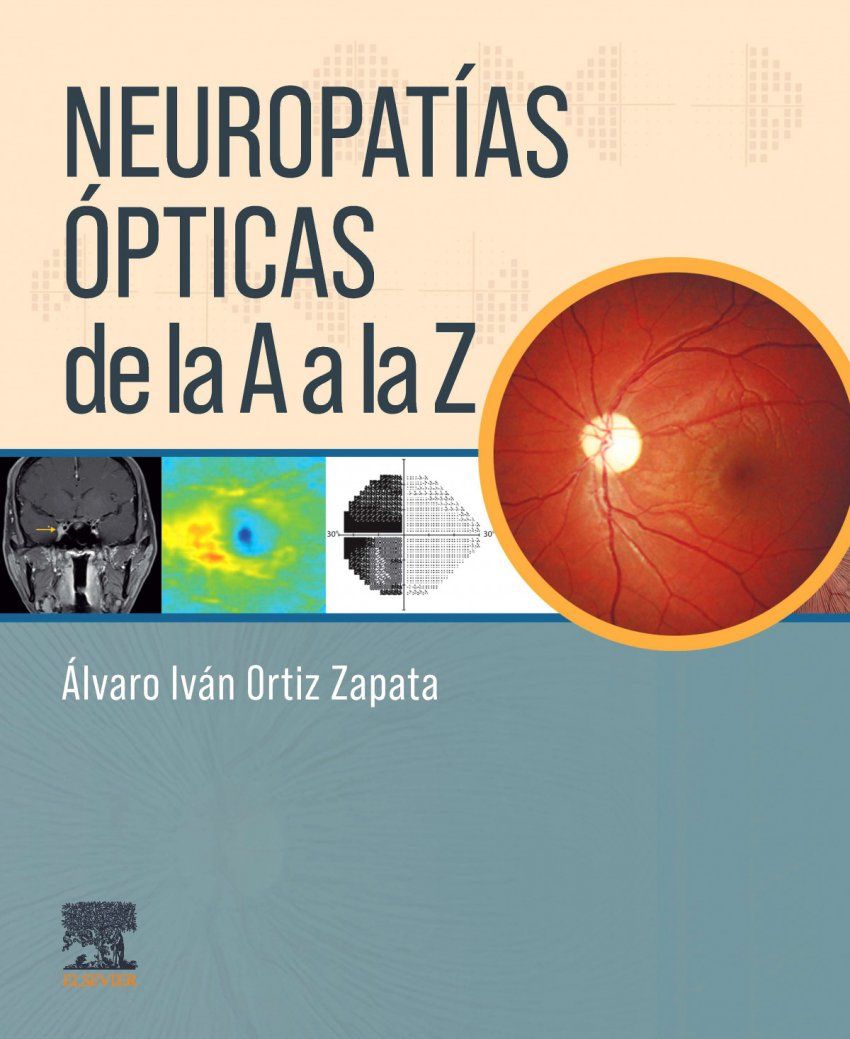 Neuropatias