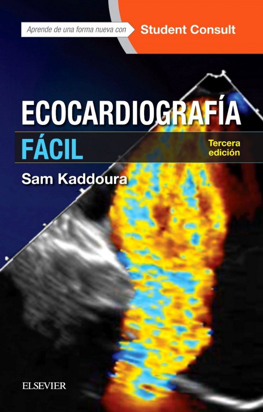 Ecocardiografia