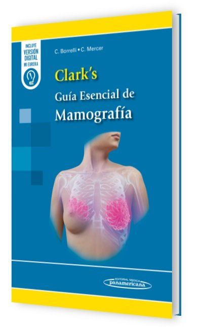 ClarksMamografia
