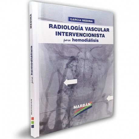 garcia medina radiologia vascular intervencionista para hemodialisis