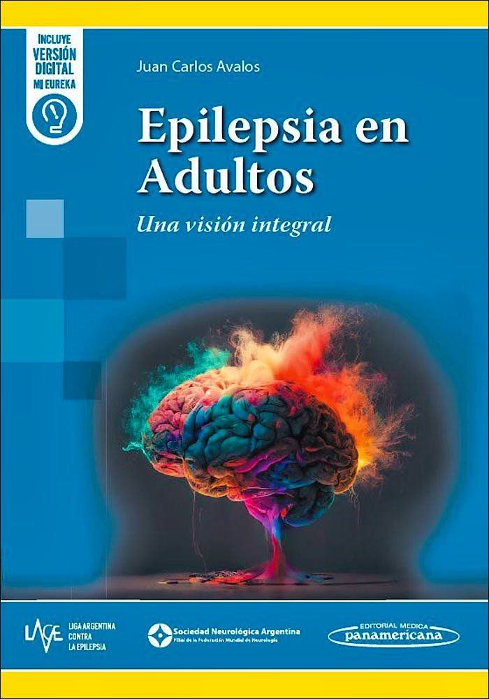 Epilepsia