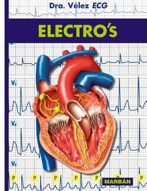 velez ecg electro s