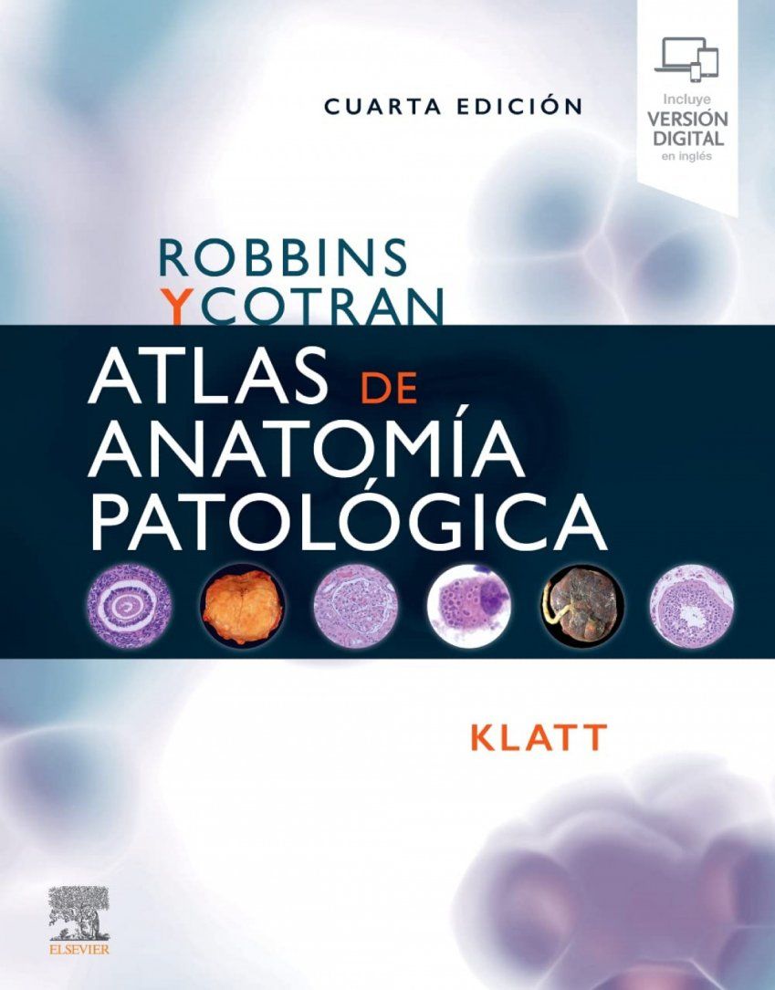 Robbins