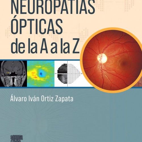 Neuropatias