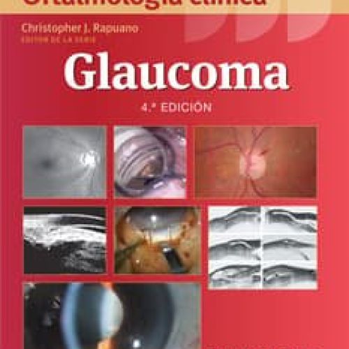 Glaucoma
