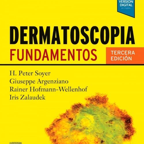 Dermatoscopia