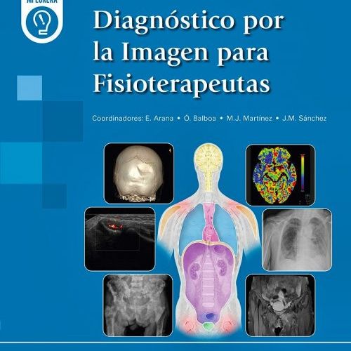 diagfisi