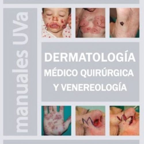 derma