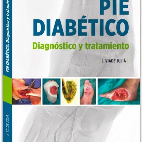 PieDiabetico