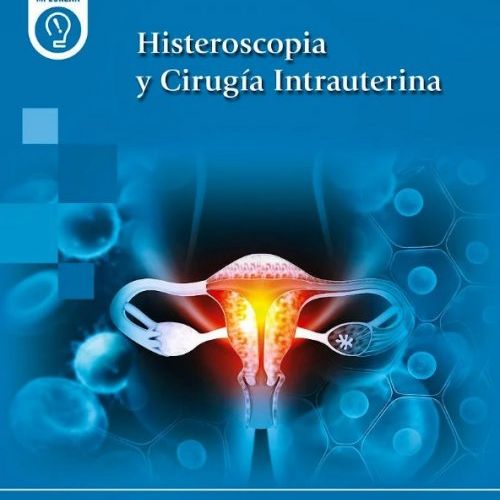 histeros