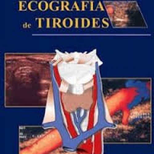 Ecografia de tiroide.RM