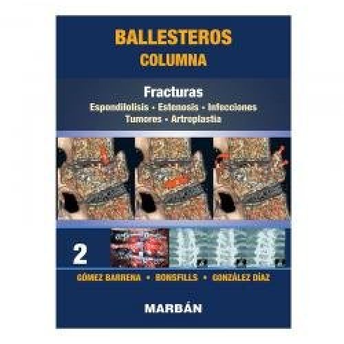 fracturas columna