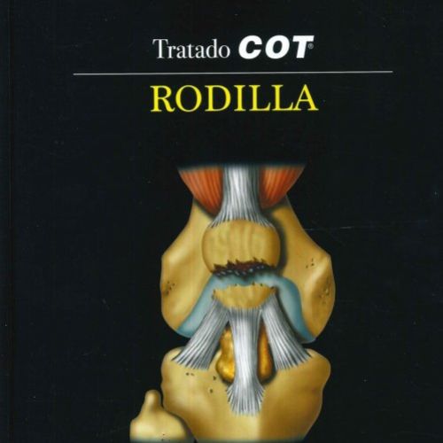 rodillacot