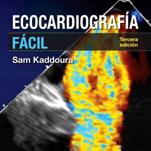 Ecocardiografia