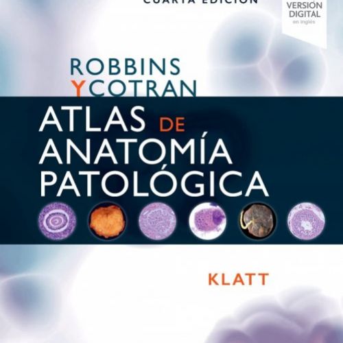 Robbins