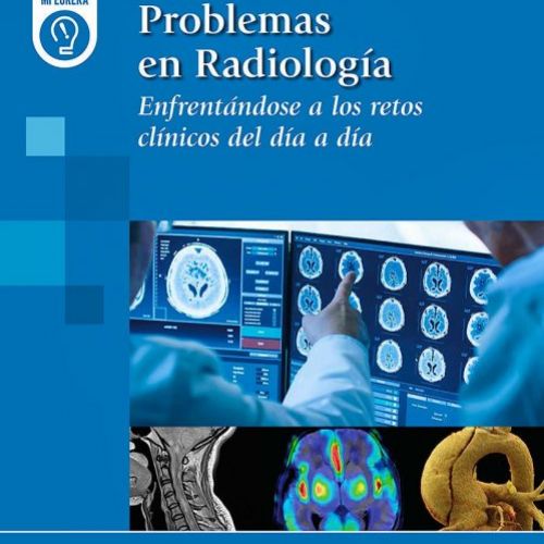 RadiologiaProb