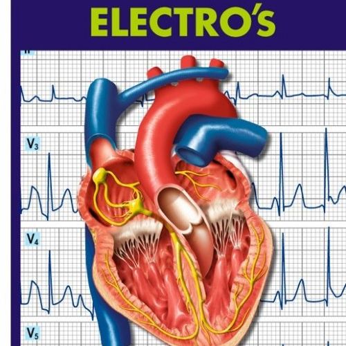 velez ecg electro s