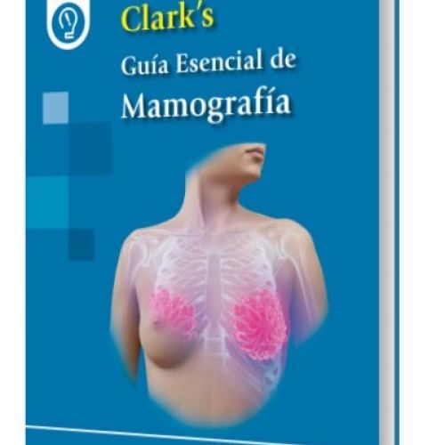 ClarksMamografia