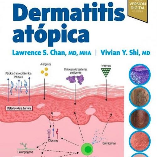 Dermatitis